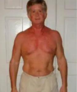 Tom after