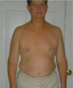 Tom before